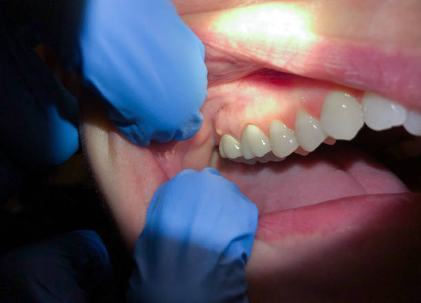 Best Weekend Emergency Dentist in Lake Kerr, FL
