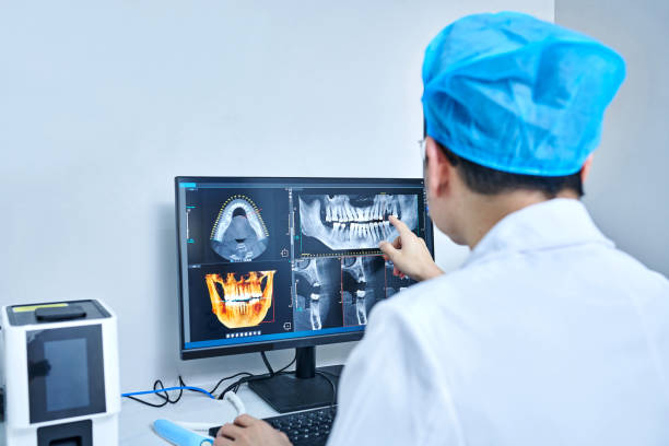 Best Emergency Dental Extractions in Lake Kerr, FL