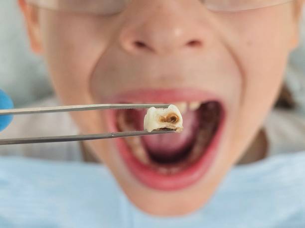 Best Emergency Dentist for Special Needs Patients in Lake Kerr, FL