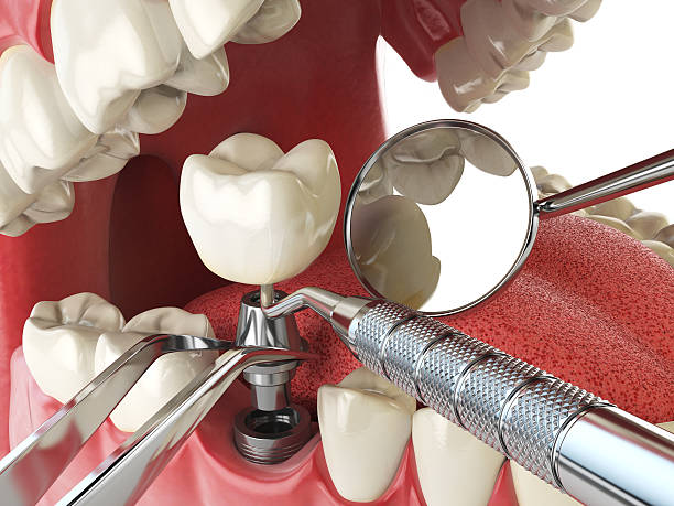 Best Emergency Cosmetic Dentistry in Lake Kerr, FL